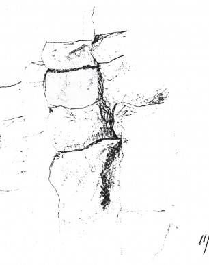 causewaysketch